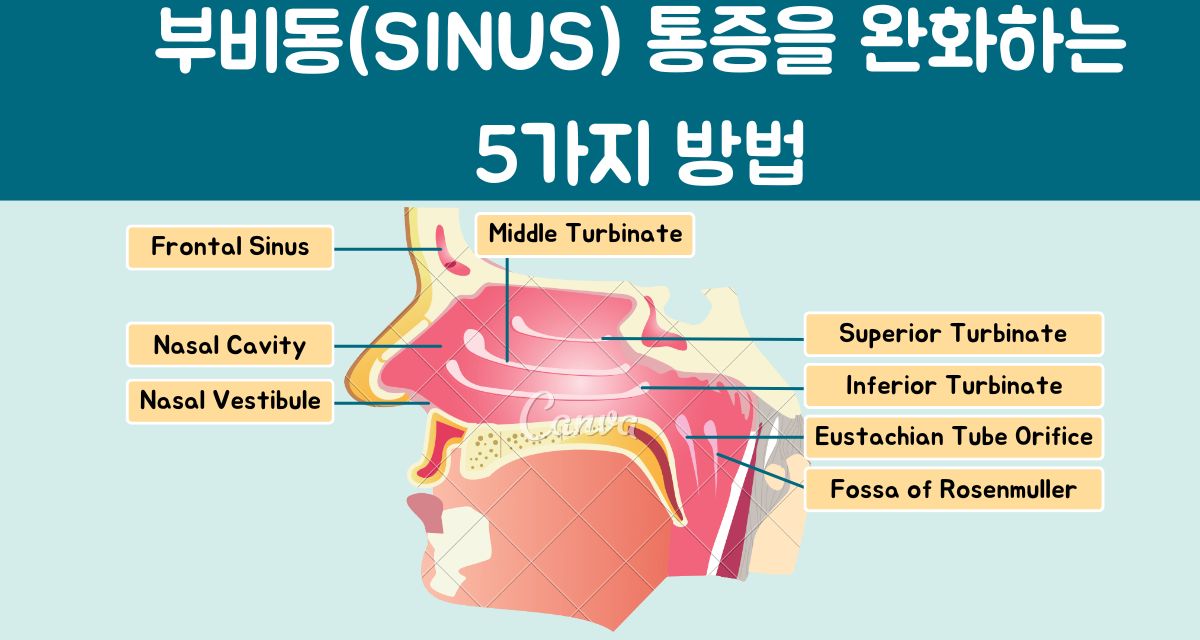 부비동염 통증 완화